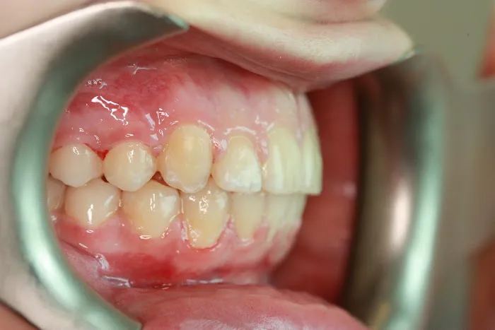 Eatonville Dental Picture 6