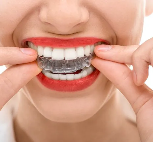 Eringate Dental Clinic | Dr. M. Victoria Razon-Clemente and Associates Picture 2