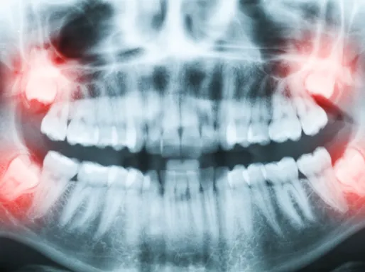 Markham Dental - General and Cosmetic Dentistry Picture 3