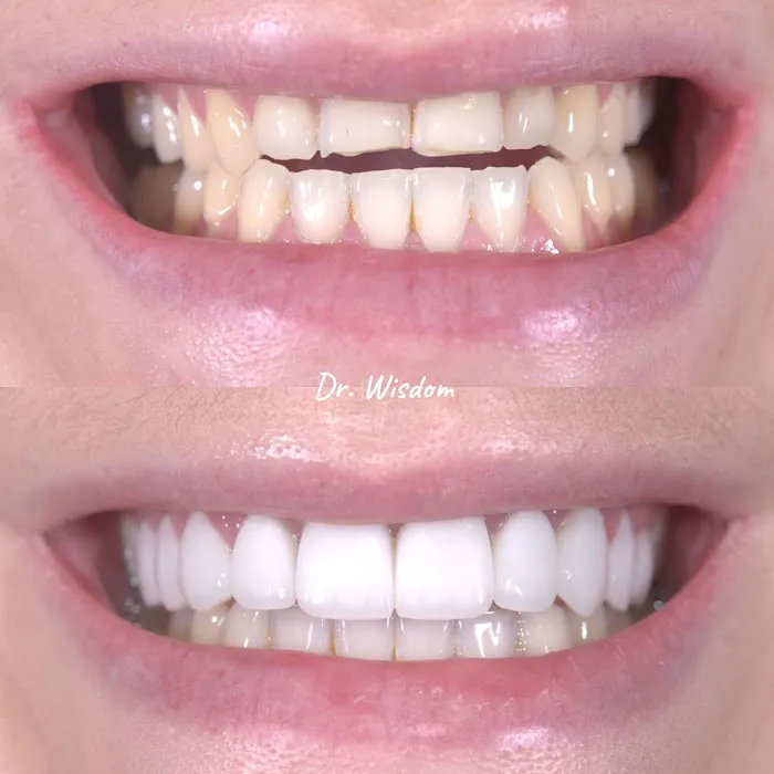 Dr. Wisdom - Dentiste Montreal - Centre Dentaire Aoude VSL Picture 10