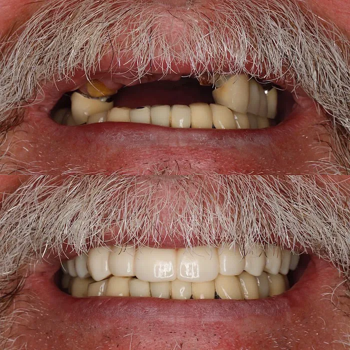 West Bowmanville Family Dental Picture 9