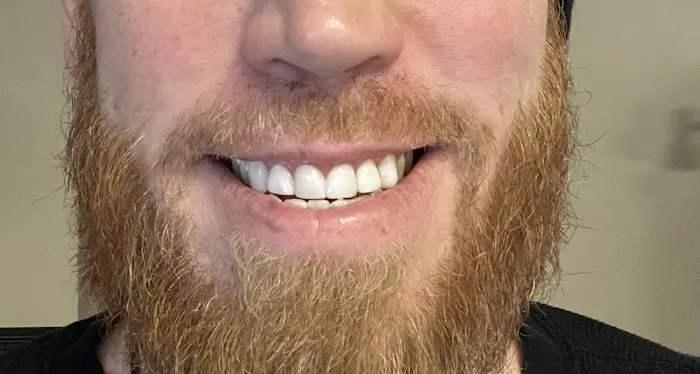 Newcastle Smile Dental Centre Picture 6