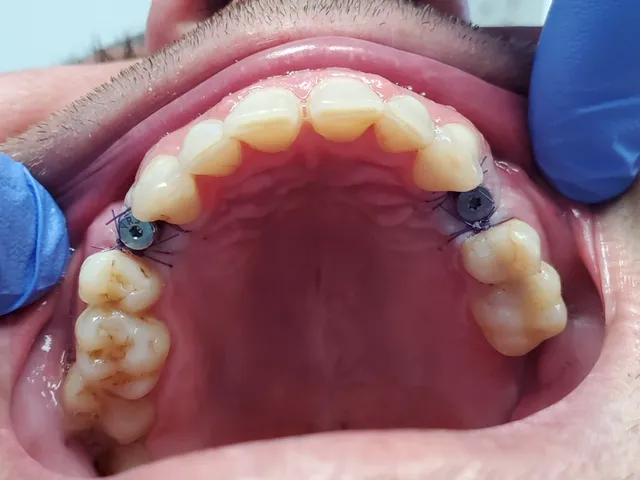 Aquadent Dental Care Picture 3