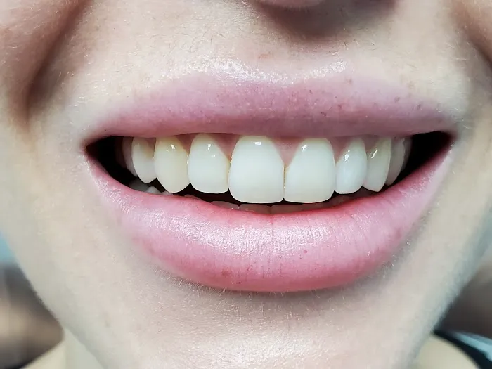Aquadent Dental Care Picture 1