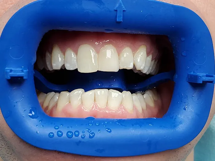 Aquadent Dental Care Picture 8