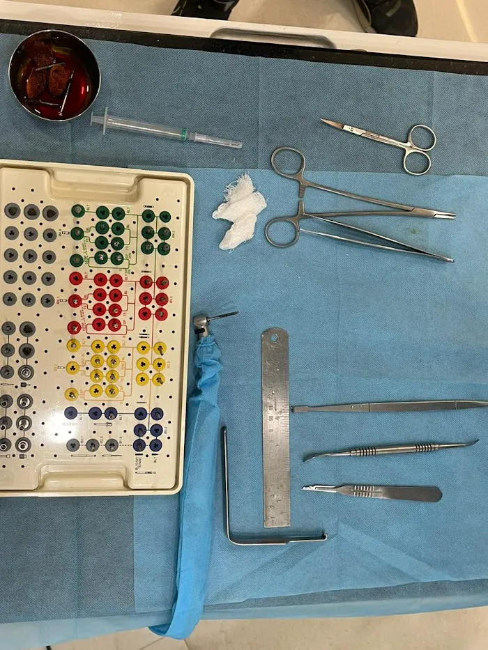 Dent Horizonz | Best Dentist in Gurgaon | Root Canal, Dental Implants, Wisdom Tooth Removal, Pediatric and General Dentistry Picture 9