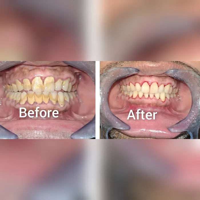 Dent Horizonz | Best Dentist in Gurgaon | Root Canal, Dental Implants, Wisdom Tooth Removal, Pediatric and General Dentistry Picture 2