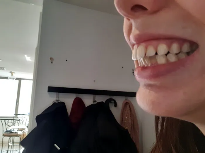 Warm Smiles Dental Centre (Formerly Nova Denture and Implant Centre) Picture 4