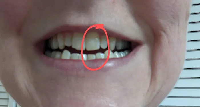 Herndon Smile Design Picture 2