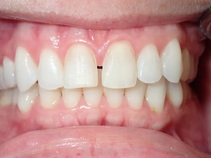 Reston Heights Dental Picture 1
