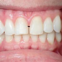 Reston Heights Dental ico