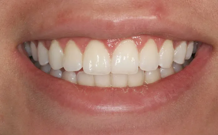 Naturadent, P.C. / DON KANG, DMD. Picture 2