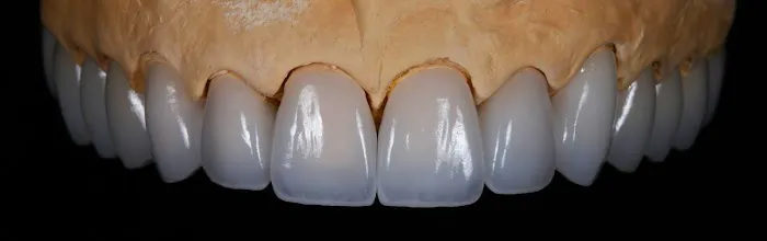 Prostho Endo Dental Specialists Aesthetic & Implant Dentistry at Vienna Picture 3