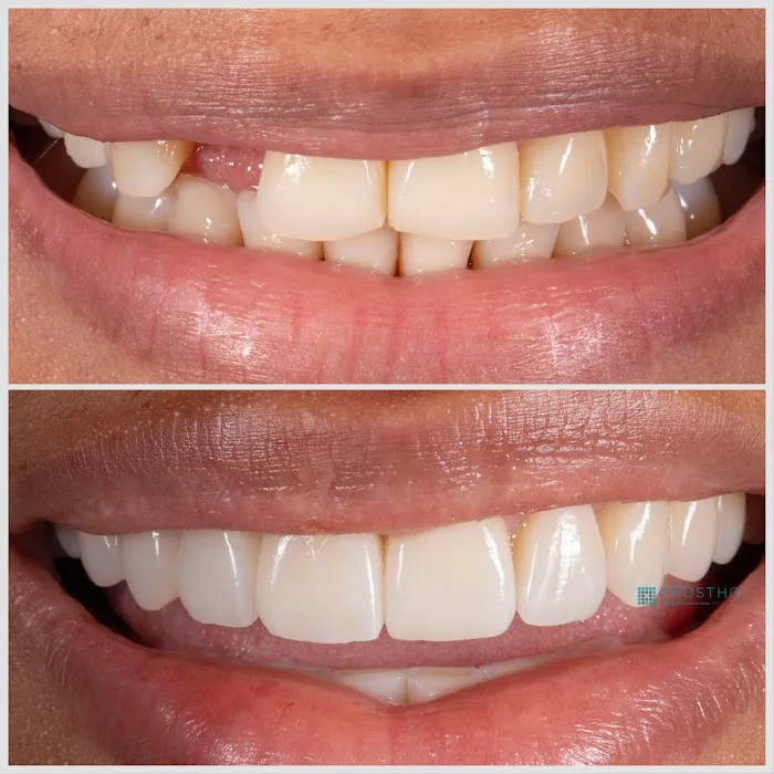 Prostho Endo Dental Specialists Aesthetic & Implant Dentistry at Vienna Picture 9