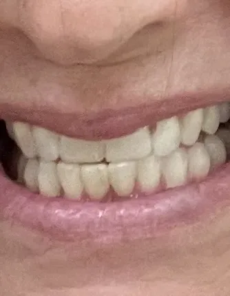 Novel Smiles Picture 6