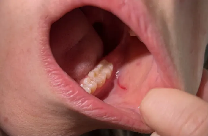 Hamilton Dental Picture 6