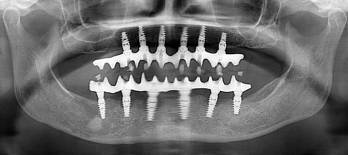 Ridgetop Dental - Reston Picture 4