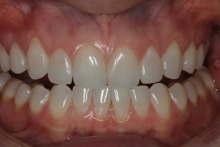 Ridgetop Dental - Reston Picture 2