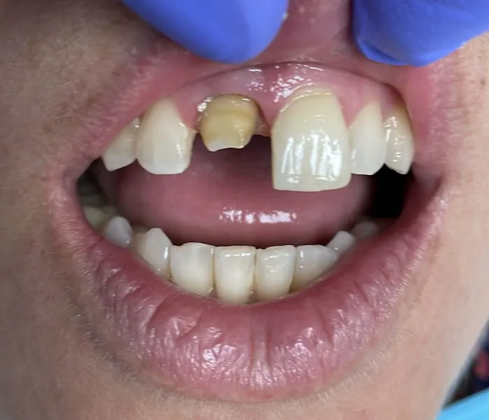 Aesthetic Dental Greenpoint Brooklyn Picture 5