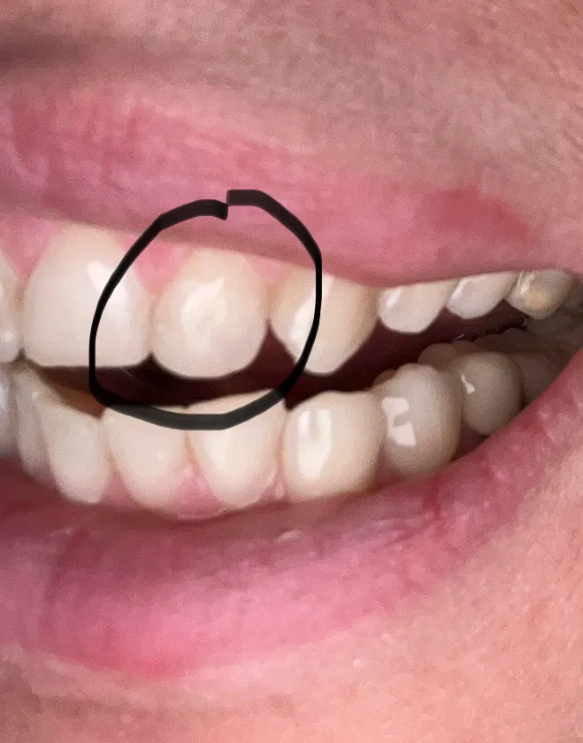 Perfect Dental Care Picture 5