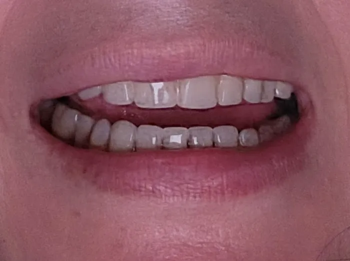Dental Corner Picture 8