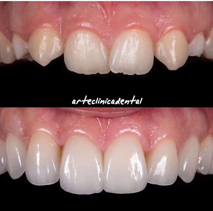 ARTE CLINICA DENTAL Picture 2