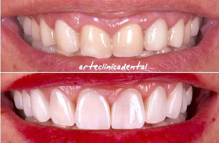 ARTE CLINICA DENTAL Picture 1