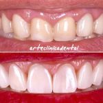 ARTE CLINICA DENTAL