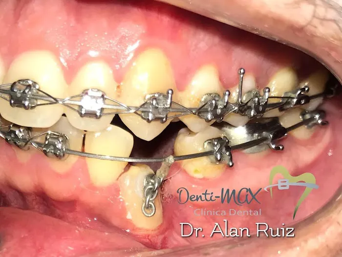 Denti-MAX Clinica Dental Picture 8