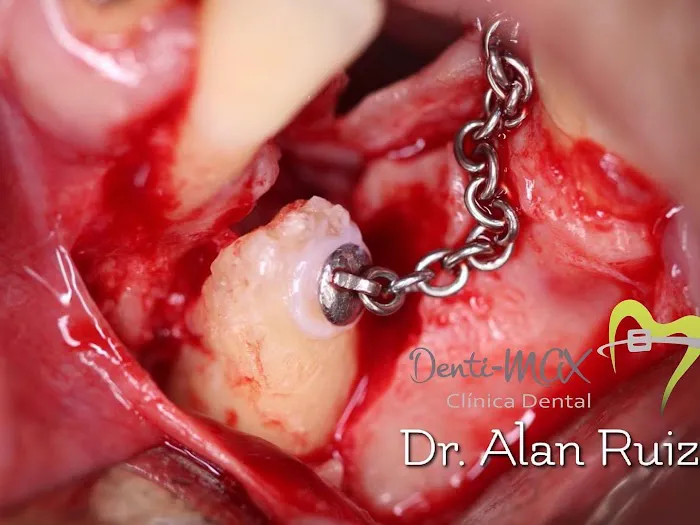Denti-MAX Clinica Dental Picture 4