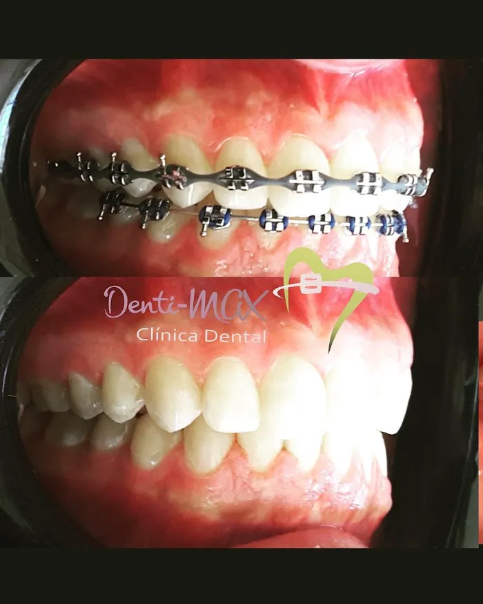 Denti-MAX Clinica Dental Picture 1