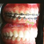 Denti-MAX Clinica Dental