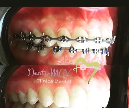 Denti-MAX Clinica Dental
