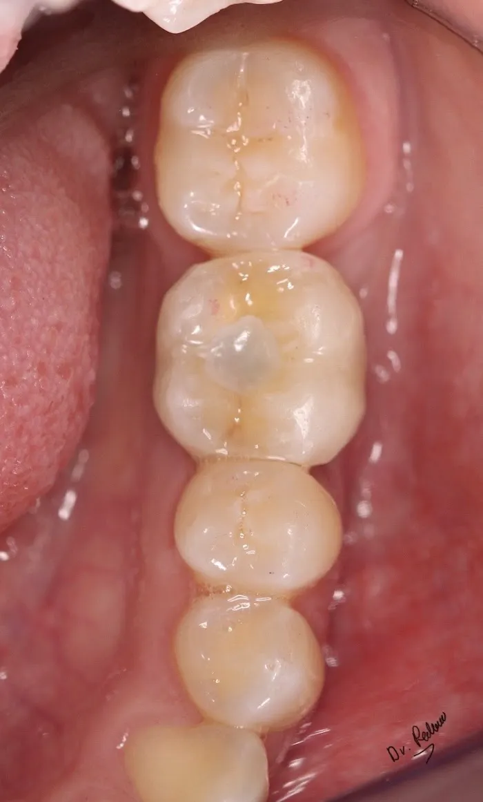 Dent Clínica de Especialidades Dentales Picture 8