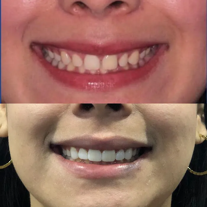 Villa Dental Dentista San Luis Rio Colorado Picture 8