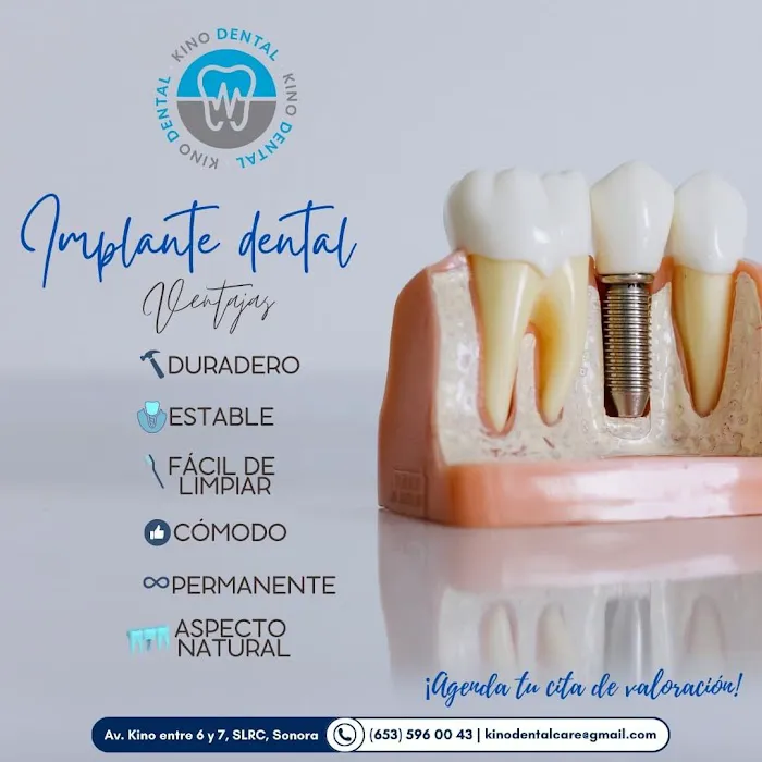 KINO DENTAL Picture 10