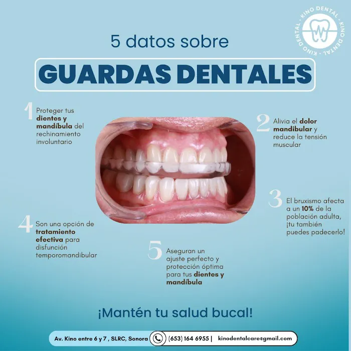 KINO DENTAL Picture 8