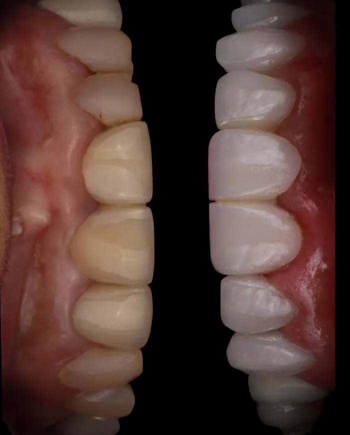 CLINICA DENTAL TENORTH® Ortodoncia & Odontologia General Picture 6