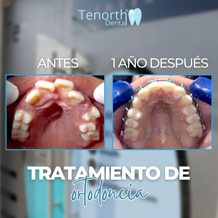 CLINICA DENTAL TENORTH® Ortodoncia & Odontologia General Picture 5
