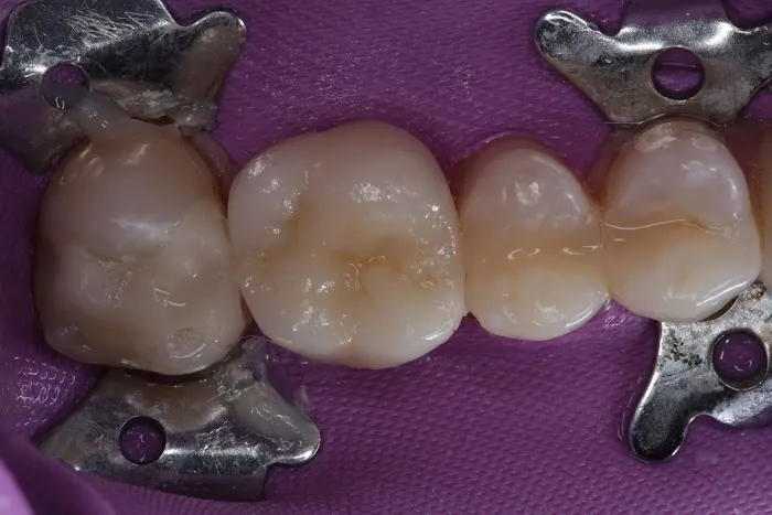 OnDent Clinic Picture 5