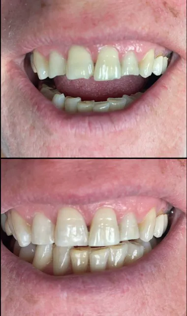 De Zavala Dental Picture 6