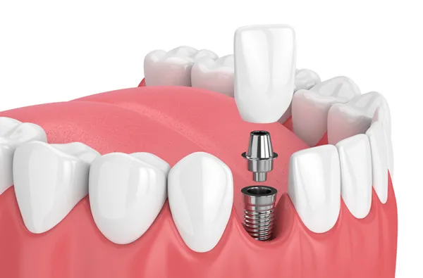 Alamo Family & Cosmetic Dentistry Picture 2
