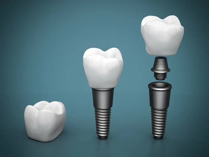 Alamo Family & Cosmetic Dentistry Picture 4