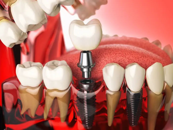 Smilee Dental Centre Picture 1