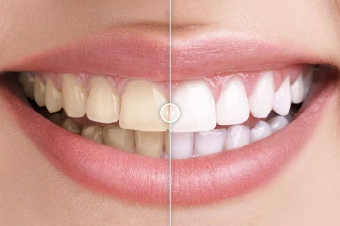Smilee Dental Centre Picture 9