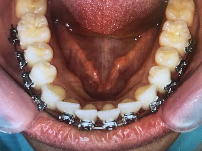 Ora-Dent Picture 6