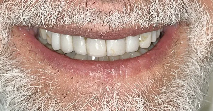 Ora-Dent Picture 8