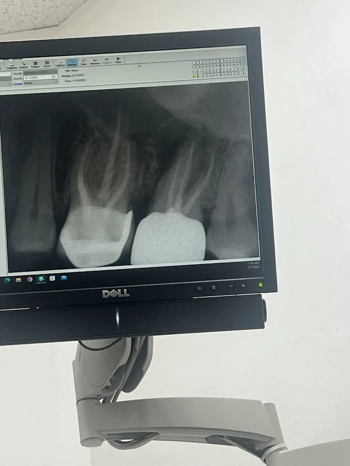 Ora-Dent Picture 3