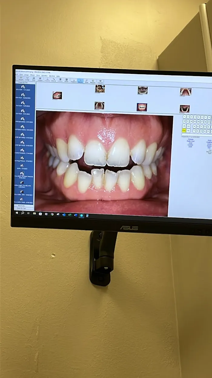 Ora-Dent Picture 7