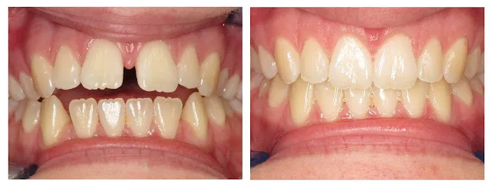 WellSmiles Dental Office at Greenway Picture 4